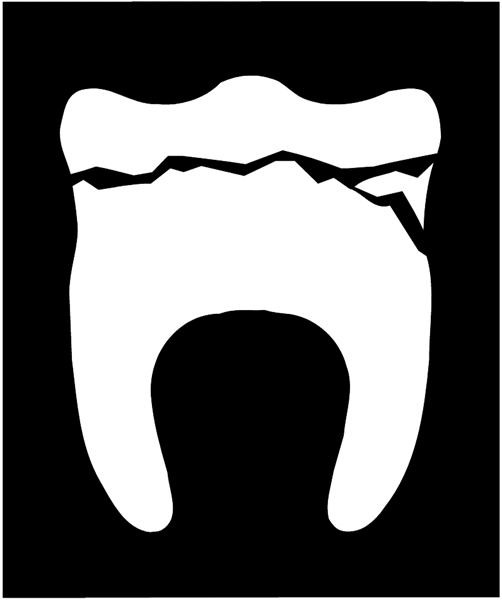 Broken tooth vinyl sticker. Customize on line. Insurance 055-0052